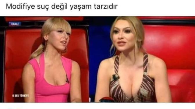 Hadise estetik mi oldu acaba 🤔😒?
