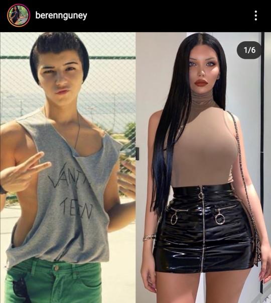 Beren Guney Trans oldugunu acikladi?