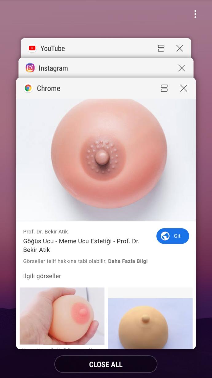 Meme ucumda fotoğraftaki kadar 3 tane nokta var normal midir?