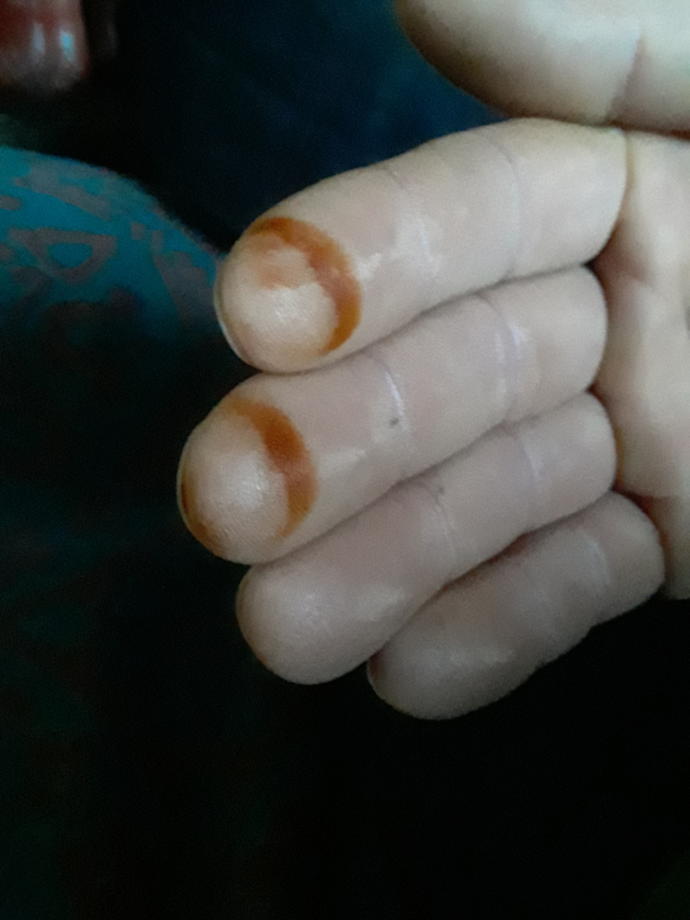 Sabah parmaklarımda kına ile uyandım. Ne anlama geliyor bu (resimli)?