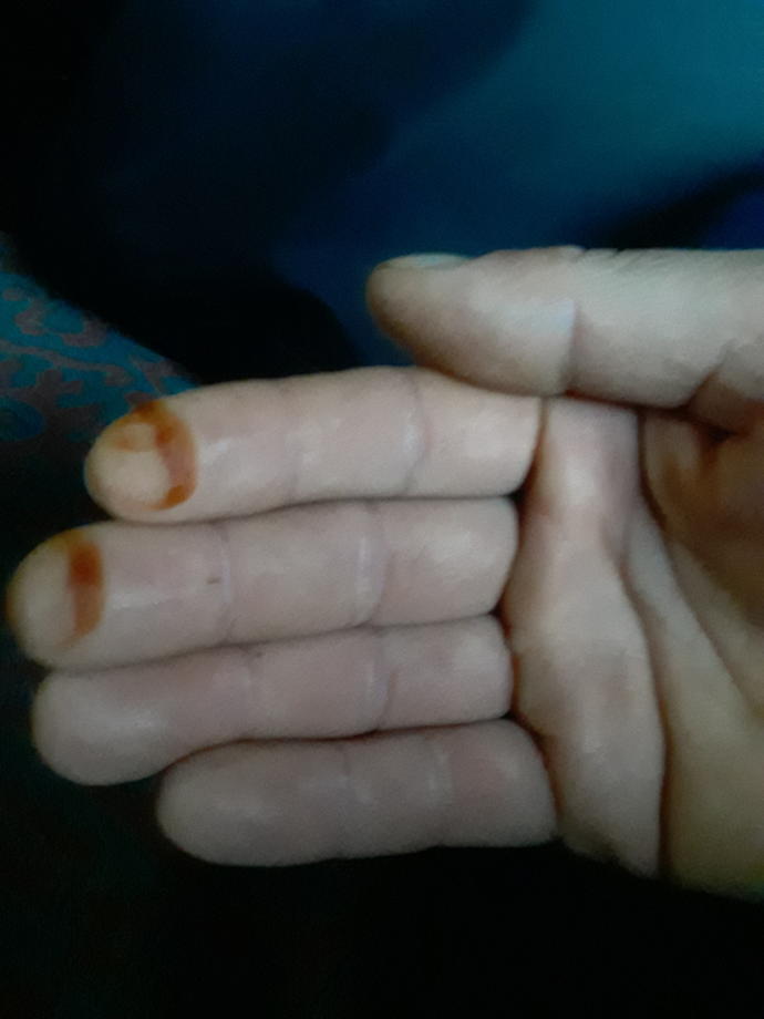 Sabah parmaklarımda kına ile uyandım. Ne anlama geliyor bu (resimli)?