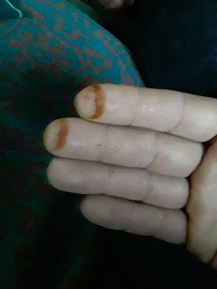 Sabah parmaklarımda kına ile uyandım. Ne anlama geliyor bu (resimli)?