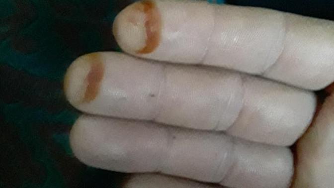 Sabah parmaklarımda kına ile uyandım. Ne anlama geliyor bu (resimli)?