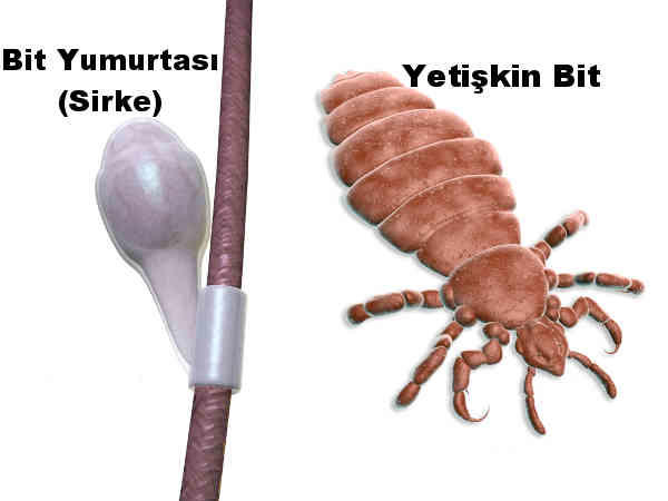 Saçımı tararken bunu gördüm. Saçımdan düşmüş olabilir mi?