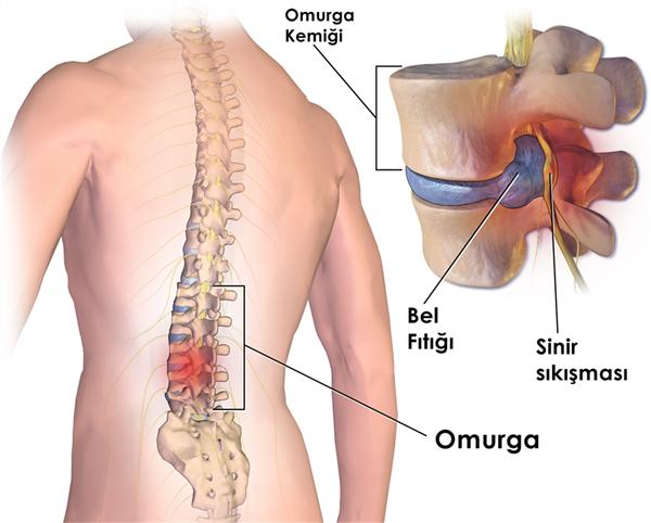 Kulunç ağrılarım ve başlangıç bel fıtığım var hangi̇ egzersizleri öneri̇rsi̇ni̇z ve neden?