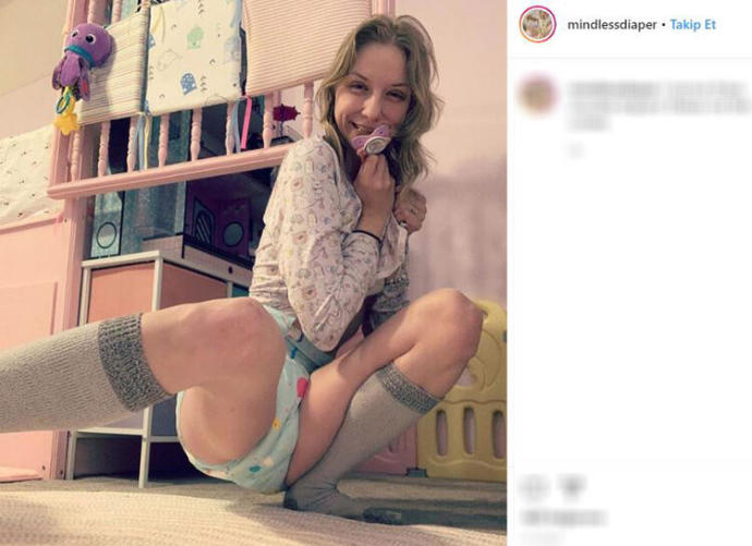 25 yaşında bebek gibi yaşıyor... Bez masraflarını hayranları karşılıyor! Sizin böyle bir kazulet bebeğiniz olsa ne yaparsınız?
