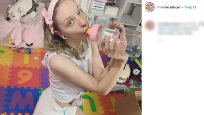 25 yaşında bebek gibi yaşıyor... Bez masraflarını hayranları karşılıyor! Sizin böyle bir kazulet bebeğiniz olsa ne yaparsınız?