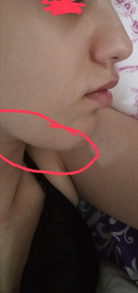 Burnumun estetiğe ihtiyacı var mı ve gıdığım çok mu kötü duruyor?