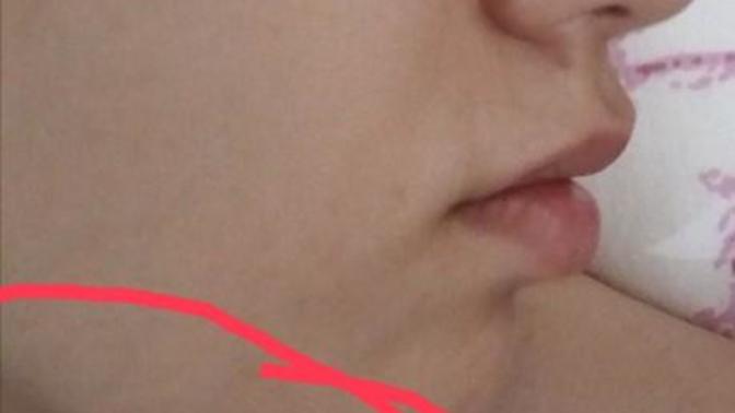 Burnumun estetiğe ihtiyacı var mı ve gıdığım çok mu kötü duruyor?
