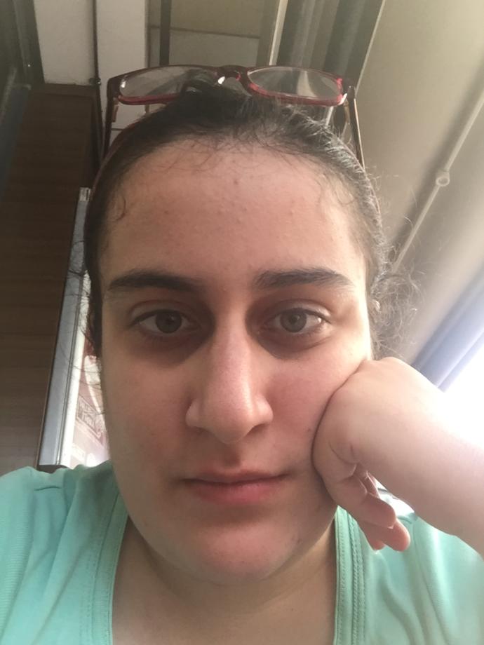 Arkadaşlar ben çok çirkinim be yapacağım?