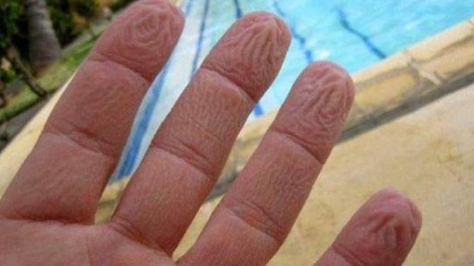 Parmaklar suda kalınca neden buruşuyor?