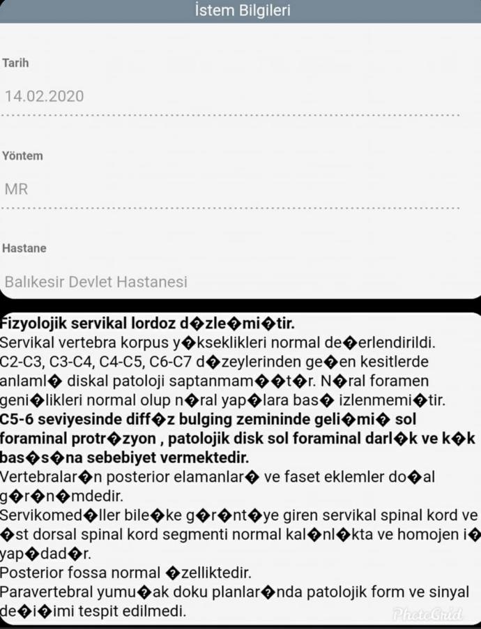 Denge kaybı neden olur?