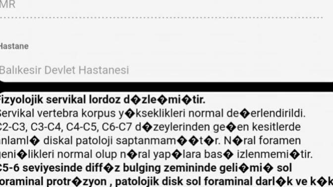 Denge kaybı neden olur?