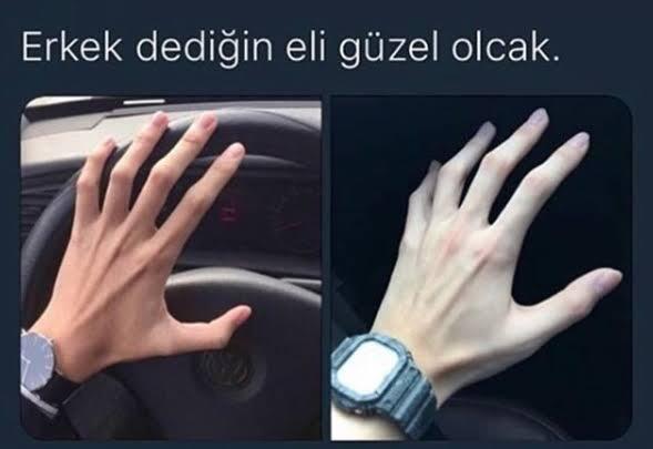 Eli böyle olan erkekler hakkında düşünceleriniz neler?
