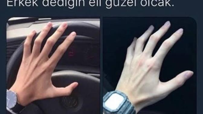 Eli böyle olan erkekler hakkında düşünceleriniz neler?