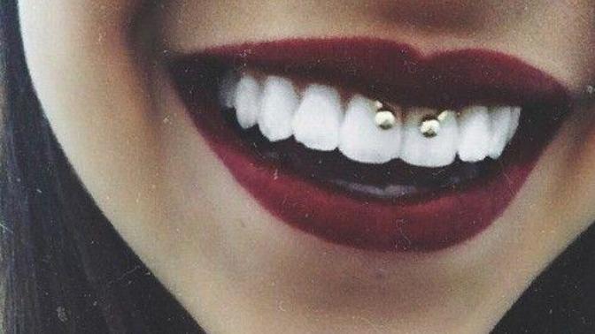 Smiley piercing?