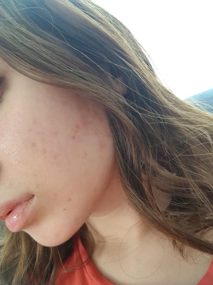 sağ yanak