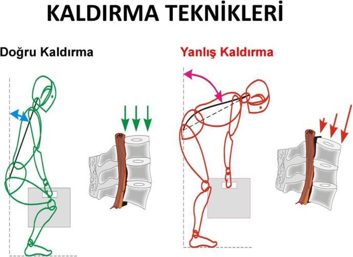 Ağır işte çalışıyorum. Bel ağrılarım geçmiyor, ne yapmalıyım?