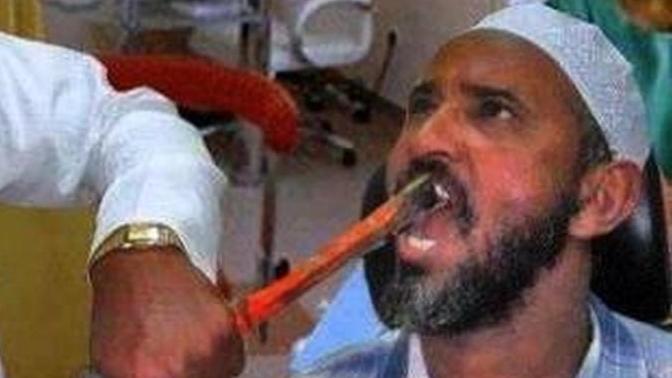 Sizce dişçiye gitmek korona riski midir?