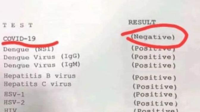 Corona testi yaptırdım negatif çıktı, siz yaptırdınız mı?
