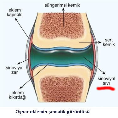 Dizlerimde eklem sıvısı artmış, ne yapmalı?
