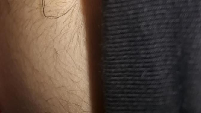 Kızlar, Göbeğimde böyle kıllar var ne yapmalıyım ağda çoğaltır mı, hormon bozukluğu olabilir mi?