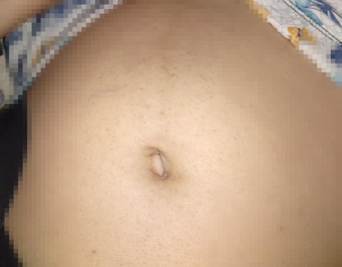 Benim