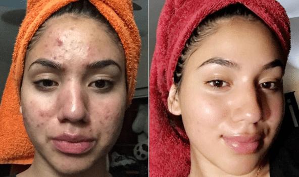 Clean Face Maske Kullananlar Yorumlarınız Nedir?
