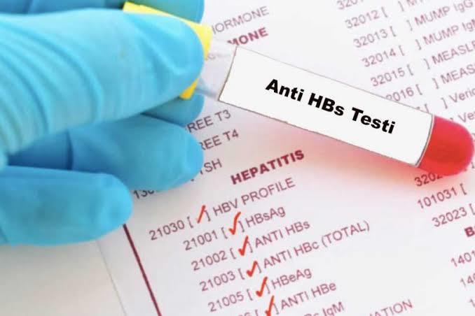 Elisa anti-hiv negatif sonuc pozitife donebilir mi?