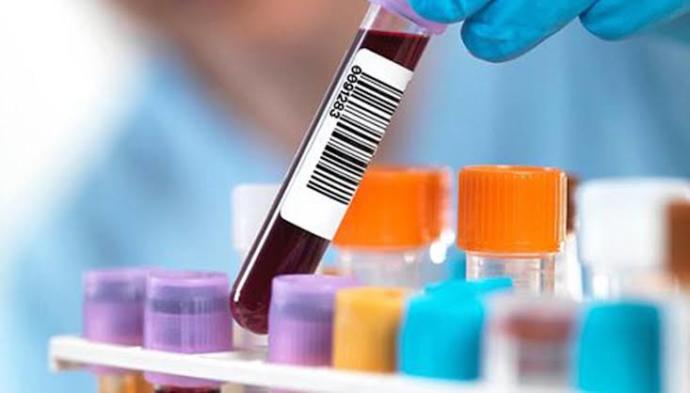 Elisa anti-hiv negatif sonuc pozitife donebilir mi?