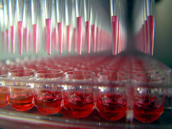 Elisa anti-hiv negatif sonuc pozitife donebilir mi?