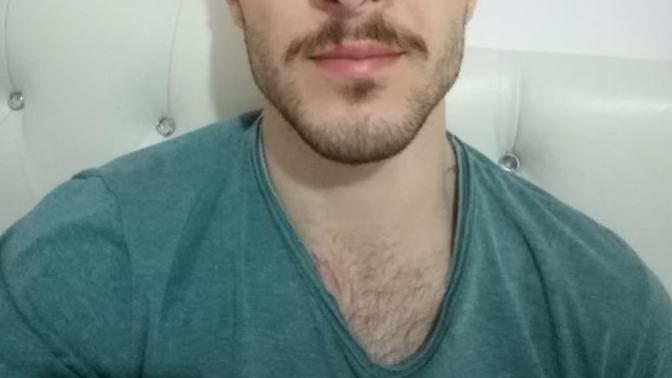 3 numara saç olmuş mu?
