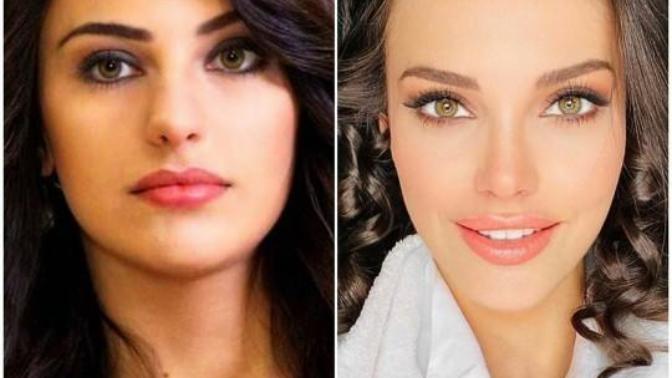 Tuvana Türkay'ın burnu çok konuşuldu! Ünlü de olsalar fiziksel özellikler eleştirilmeli mi?