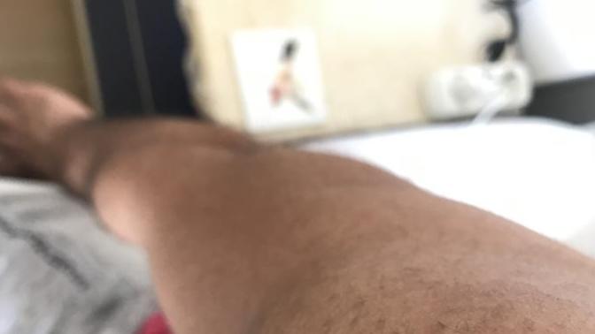 Kollarımda geçmeyen sivilceler var. Bunun için yardımcı olabilir misiniz?