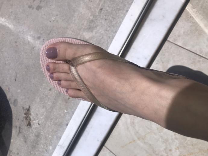Ayaklarım bana cok çirkin geliyor açık ayakkabı giymek istemiyorum?