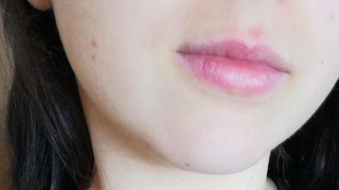 Dudaklarım neden hep kuru? Önerirsiniz nedir?