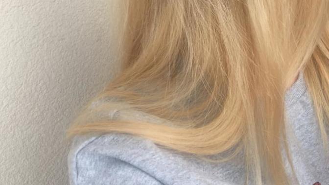 Sizce Loreal turuncu azaltıcı kullanmalı mıyım?
