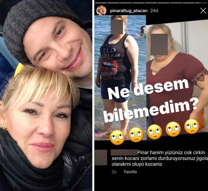 Pınar Altuğ, Yüzün çok çirkin diyen takipçisinin fotoğrafını yayınladı. Sence hangisinin davranışı yanlış?