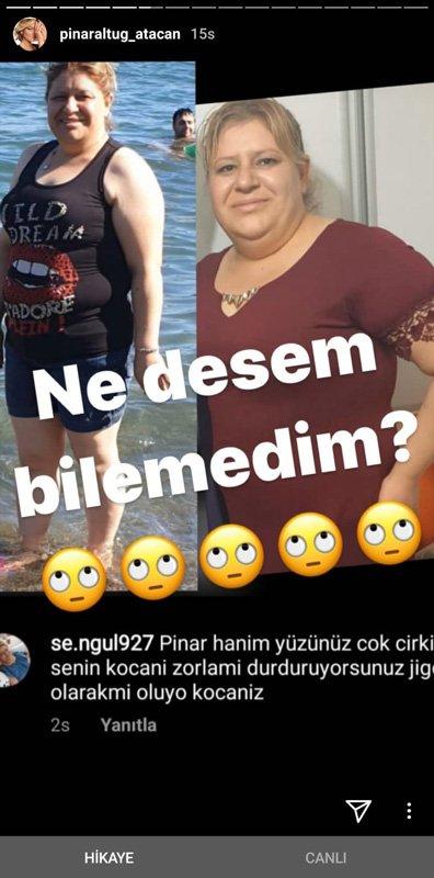 Pınar Altuğ, Yüzün çok çirkin diyen takipçisinin fotoğrafını yayınladı. Sence hangisinin davranışı yanlış?