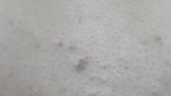 2 göğsümün ortasında arasında siyah nokta gibi şeyler?