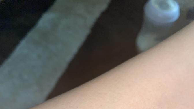 Yanmıştı nasıl tamamen geçer bu?