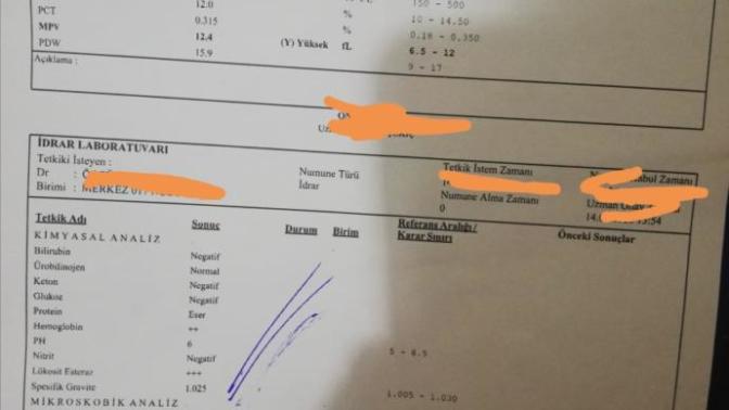 Kan ve İdrar tahlili den anlayan çıkar mı?