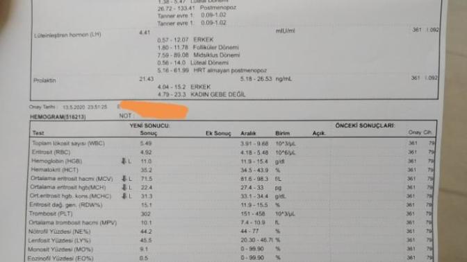 Polikistik over sendromu hakkında bilgisi olan var mı acil?