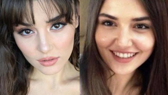 Hande Erçel'in yanakları nasıl gitmiş sizce?