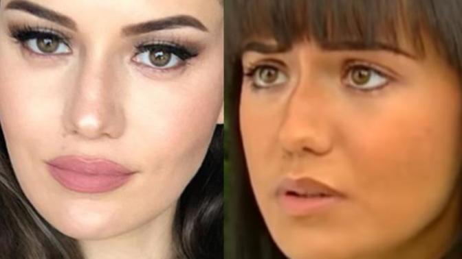Fahriye Evcen'in estetiğim yok demesi çok itici değil mi?