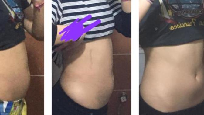 Eskiden sürekli spor yapıyordum bırakınca çok kilo aldım. Nasıl zayıflarım?