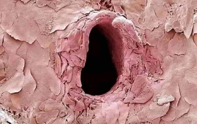 İğnenin vücutta bıraktığı deliğin mikroskobik görüntüsünü gördünüz mü?