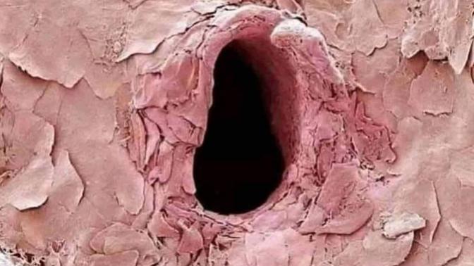 İğnenin vücutta bıraktığı deliğin mikroskobik görüntüsünü gördünüz mü?