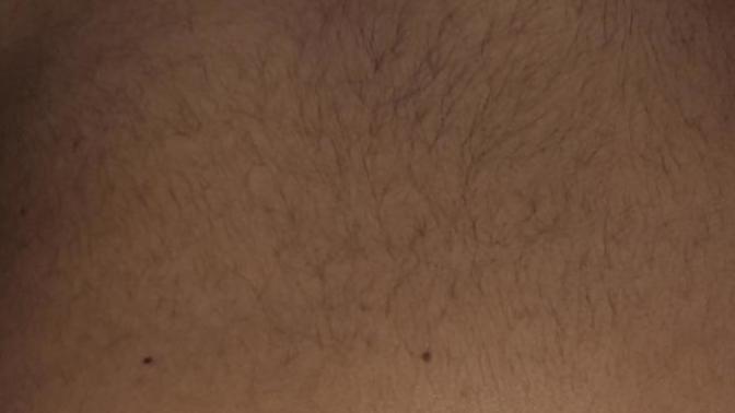 Bir hata yapıp sırtıma jilet vurdum ve kıllarım bu hale geldi ;(( napicam?