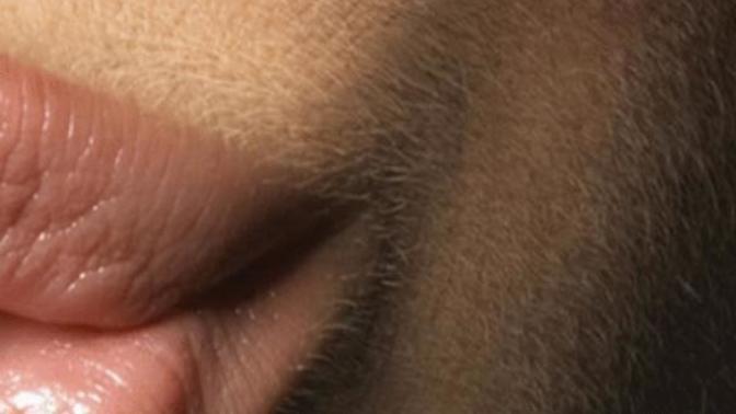 İstenmeyen tüyler nasıl azalır?